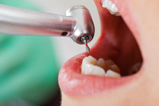 Best Same-Day Emergency Dentist in Oxford, NC